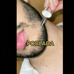 KING OF GINGER CRECER EL PELO Y BARBA